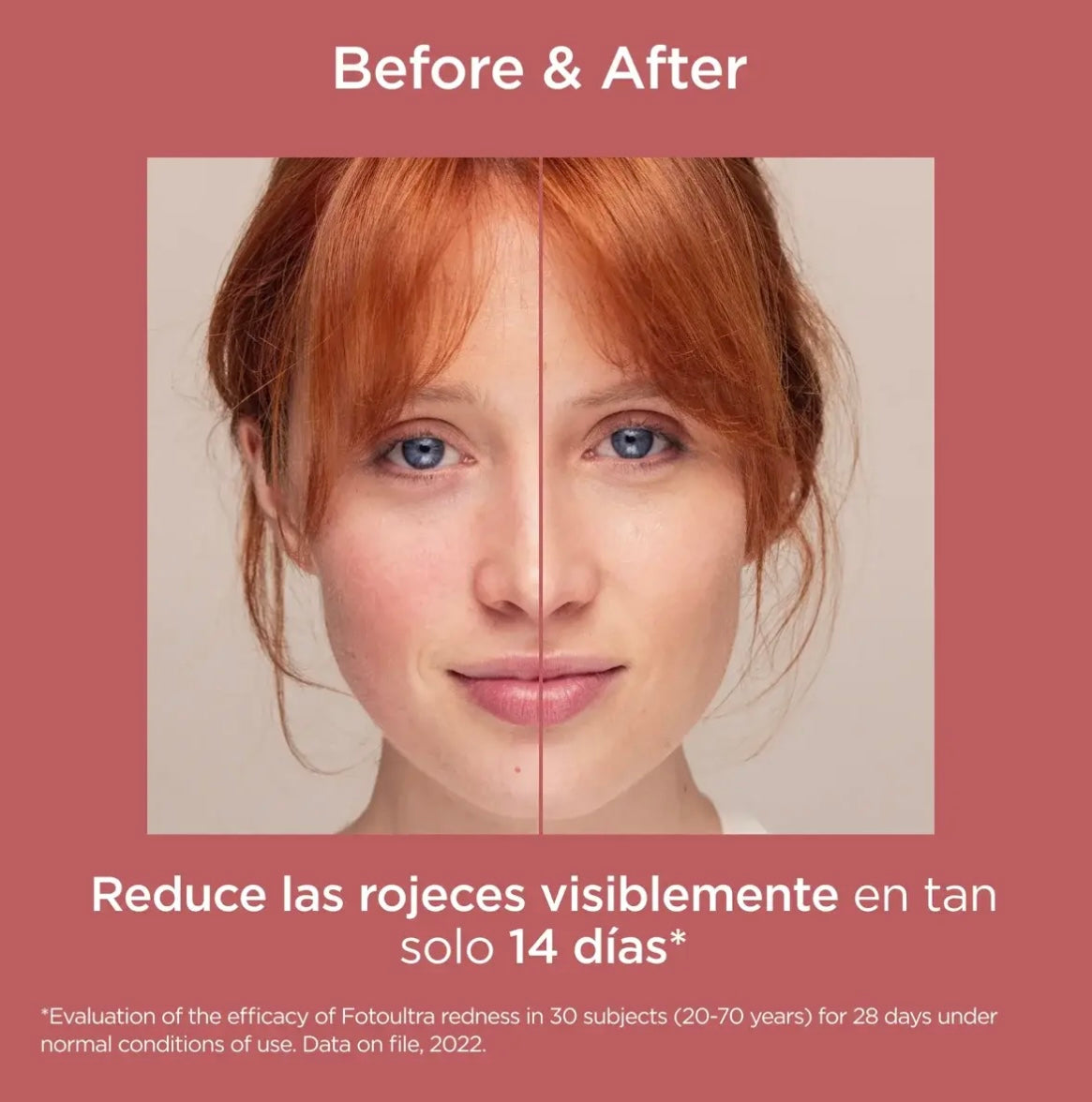 ISDIN - Redness Fotoultra 50ml