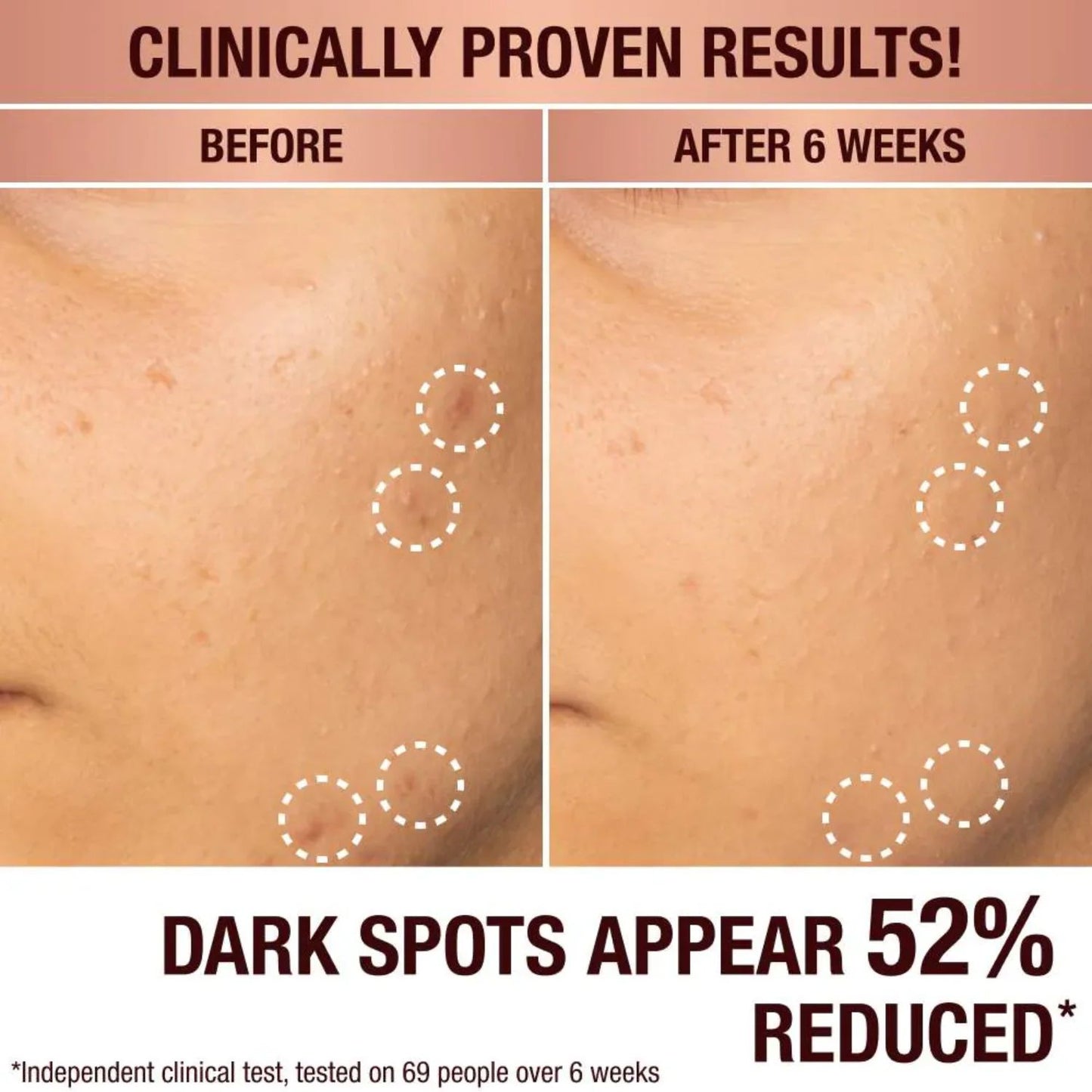 Charlotte Tilbury - Dark Spot Correcting (Sérum despigmentante) 30ml